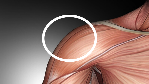 How to do an intramuscular or subcutaneous testosterone injection 4