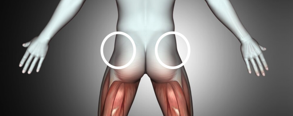 How to do an intramuscular or subcutaneous testosterone injection 5