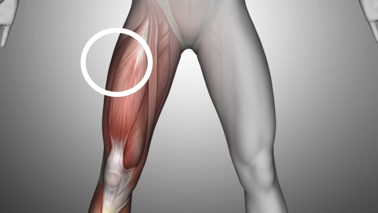 How to do an intramuscular or subcutaneous testosterone injection 6
